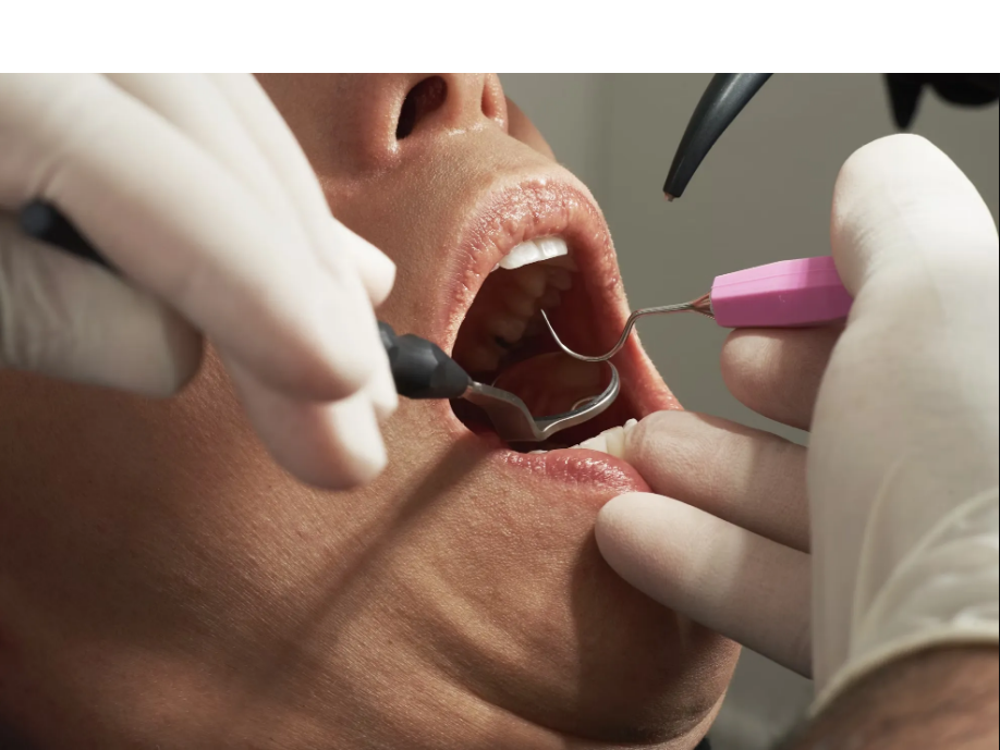 Roof of Mouth Hurts Behind Front Teeth: Causes, Symptoms, and Effective Remedies